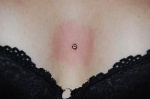 microdermal